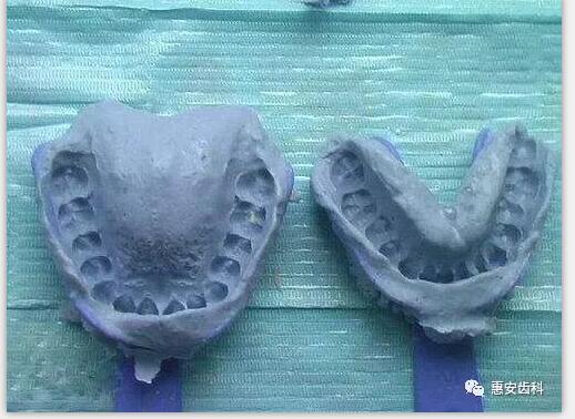 兰州口腔医院，兰州种植牙医院