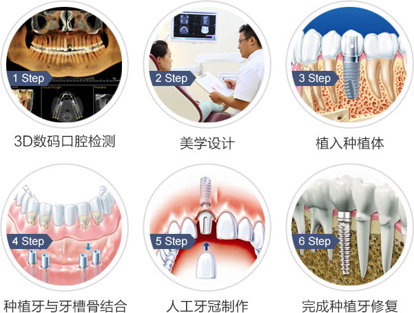 门牙缺失了怎么办，兰州牙科医院，兰州惠安齿科
