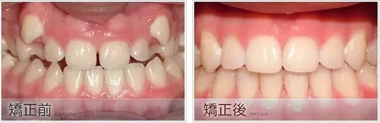 兰州口腔医院，兰州牙科