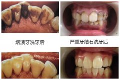 兰州口腔医院，兰州牙科