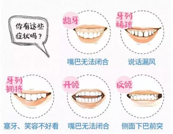 拔除4颗牙齿才能得到很好的矫治效果，拔牙太多了不会造成缝隙太大吗，这个医生是不是不靠谱?兰州惠安齿科医生介绍。