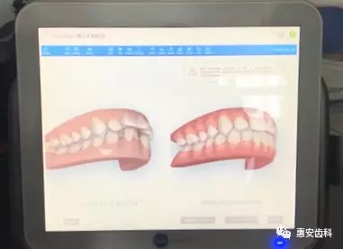 兰州牙科医院，兰州惠安齿科