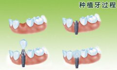 兰州口腔医院，兰州牙科