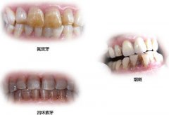 兰州口腔医院，兰州牙科