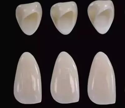 美容冠一颗牙多少钱，兰州牙科医院，兰州惠安齿科