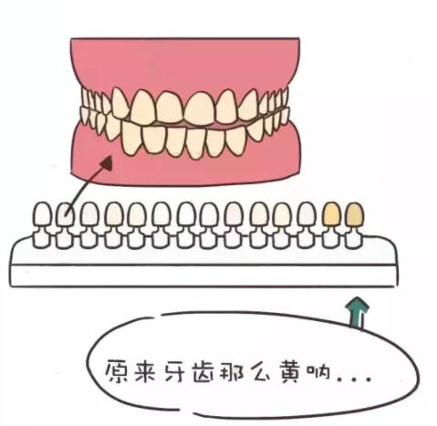 皓齿美白结果怎么样？兰州惠安齿科医生介绍。