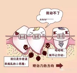 牙齿都松动了，还能牙齿矫正吗，兰州惠安齿科医生介绍