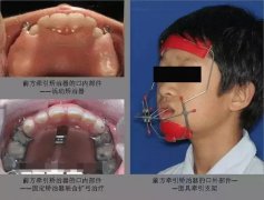 兰州口腔医院，兰州牙科