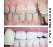 兰州口腔医院，兰州牙科
