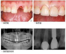兰州口腔医院，兰州牙科