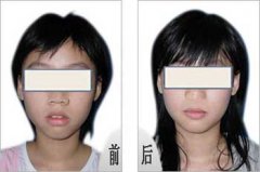 兰州口腔医院，兰州牙科