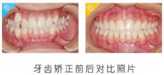 兰州口腔医院，兰州牙科