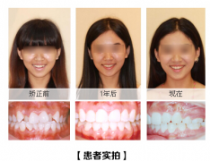 兰州口腔医院，兰州牙科