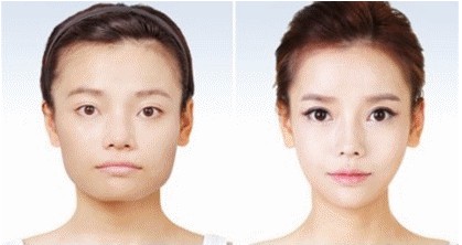 牙齿外突怎么办呢