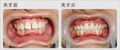 兰州口腔医院，兰州牙科