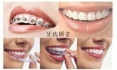 兰州口腔医院，兰州牙科