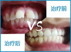 兰州口腔医院，兰州牙科