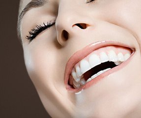 美容冠的优势