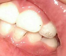 兰州口腔医院，兰州牙科