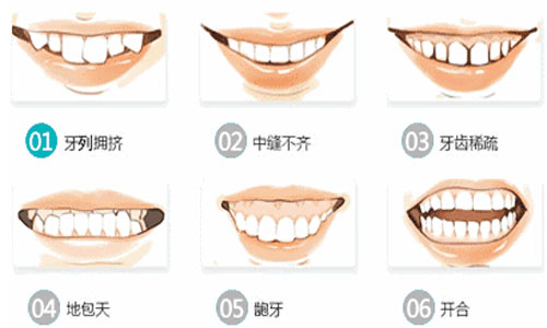 　寒假来临，  牙齿矫正，兰州牙科医院，兰州口腔医院