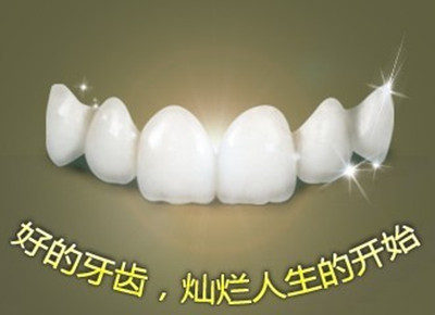 烤瓷牙都有什么样的