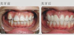 兰州口腔医院，兰州牙科