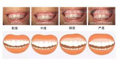 兰州口腔医院，兰州牙科