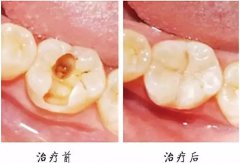 兰州口腔医院，兰州牙科
