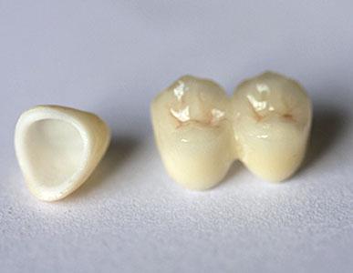 20几岁了可以做窝沟封闭吗