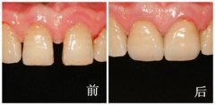 兰州口腔医院，兰州牙科
