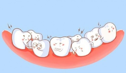 半口牙缺失为什么要做种植牙