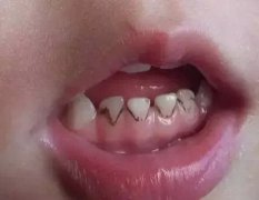 兰州口腔医院，兰州牙科