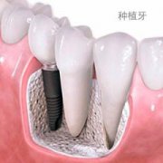 兰州口腔医院，兰州牙科