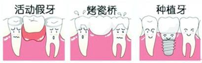 牙齿缺失做种植牙有什么优势呢