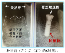 兰州口腔医院，兰州牙科