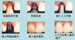 兰州口腔医院，兰州牙科