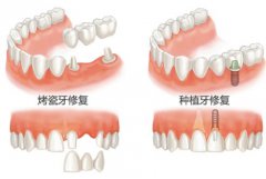 兰州口腔医院，兰州牙科