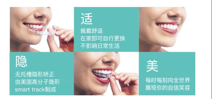 隐形牙套