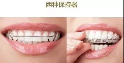 惠安齿科矫正器
