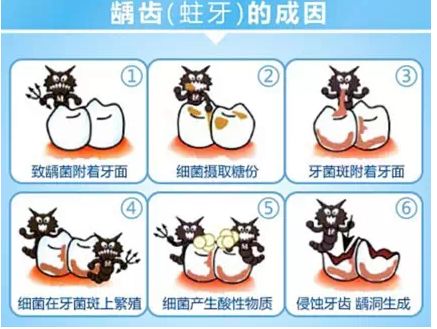 如何发现宝宝形成龋齿？