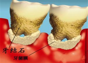 兰州口腔医院，兰州牙科