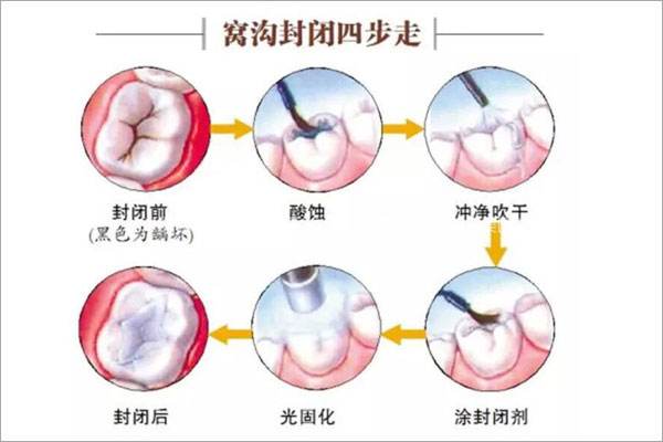 兰州口腔医院，兰州牙科