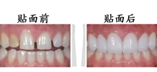 兰州口腔医院，兰州牙科