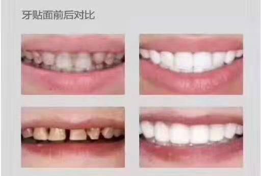兰州口腔医院，兰州牙科