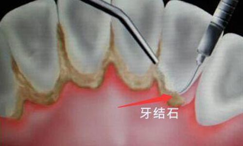 兰州口腔医院，兰州牙科