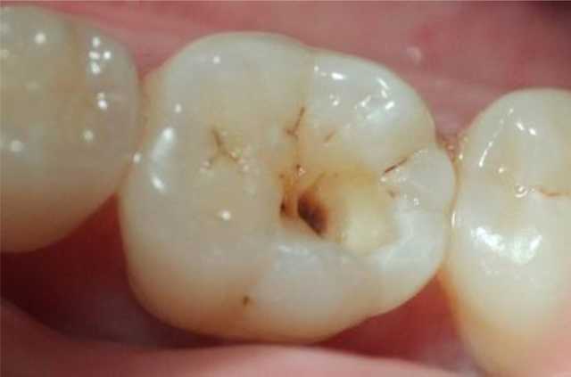 兰州口腔医院，兰州牙科