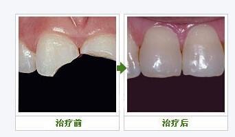 兰州口腔医院，兰州牙科