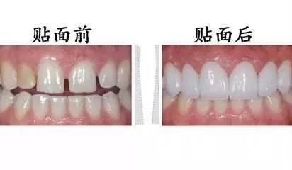 兰州口腔医院，兰州牙科
