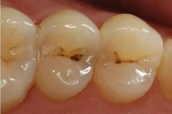 兰州口腔医院，兰州牙科