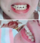 兰州口腔医院，兰州牙科